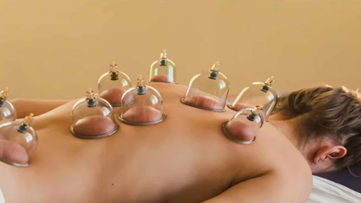 En person får cupping-behandling med glasbeholdere på ryggen i et afslappende miljø.
