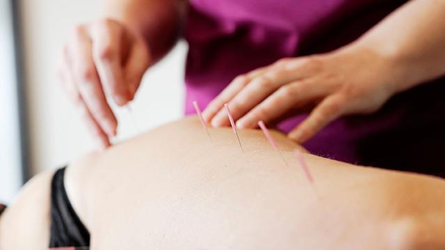 Akupunkturbehandling med nåle i ryggen på en patient, udført af en behandler i en klinik.