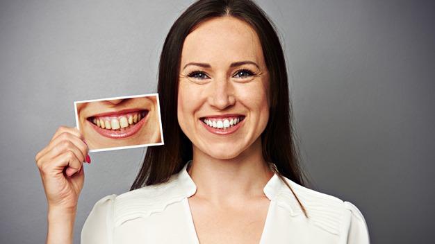 Kvinde smiler og holder et billede af et smil foran sit ansigt, med en grå baggrund.