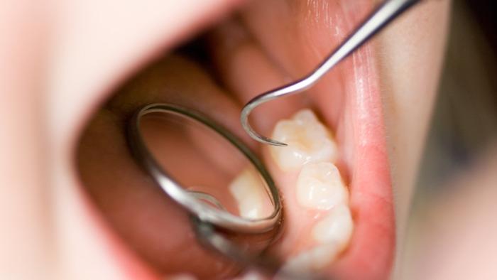 En tandlæge bruger et instrument til at undersøge tænderne i en patients mund.