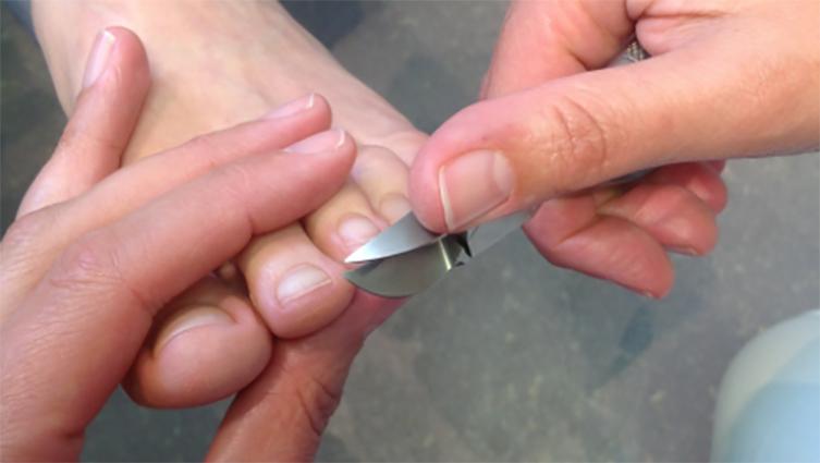 En person får pedicure, hvor en metalværktøj bruges til at forme tånegle.